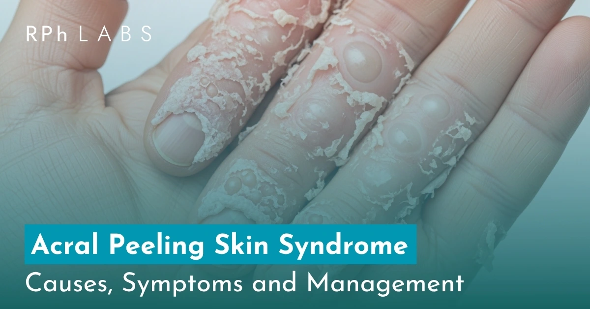 Acral Peeling Skin Syndrome: Symptoms and Management