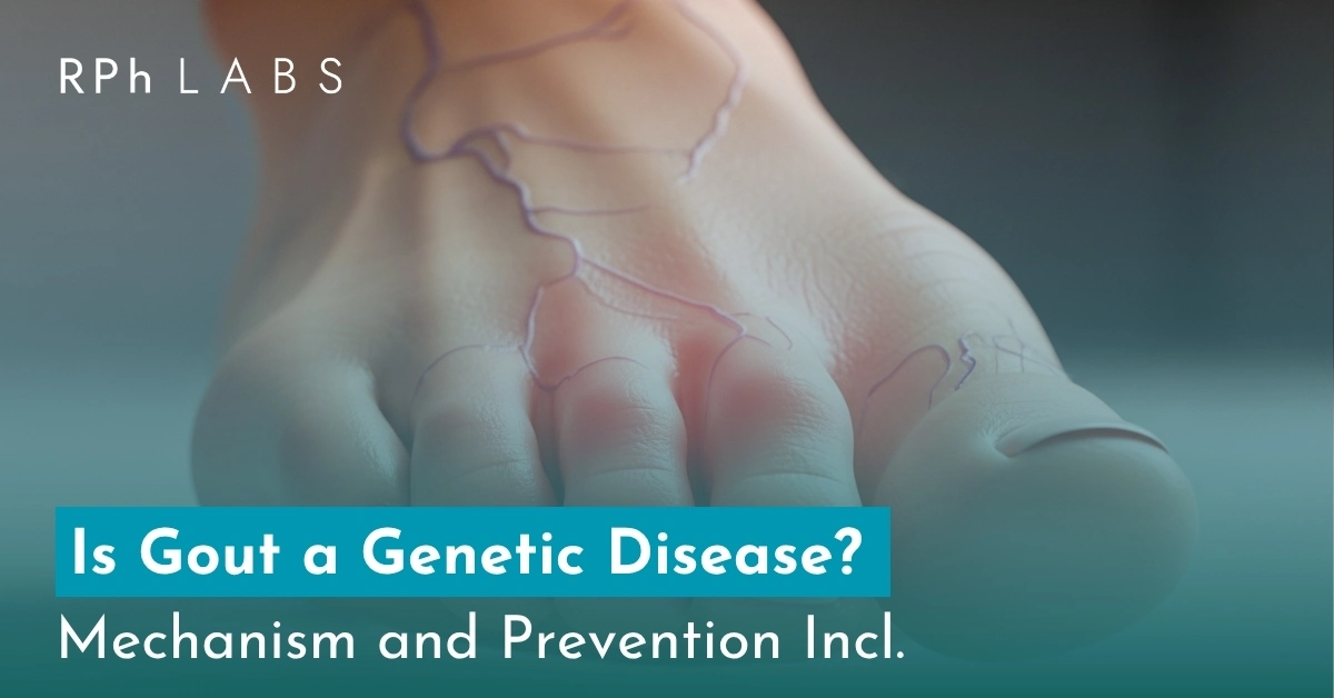 Is Gout a Genetic Disease? Mechanism and Prevention Incl.