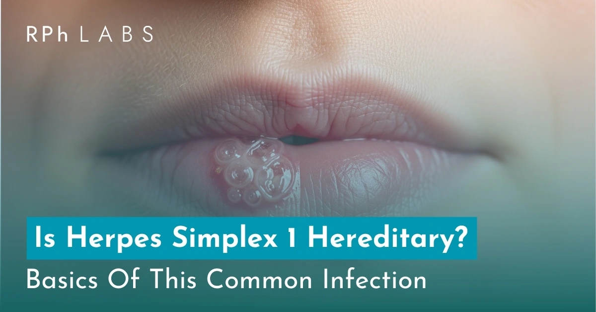 Is Herpes Simplex 1 Hereditary? Basics of Common Infection